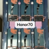 📱 ÉP KÍNH - THAY MÀN HÌNH HONOR 70 LẤY NGAY TẠI TP.HCM